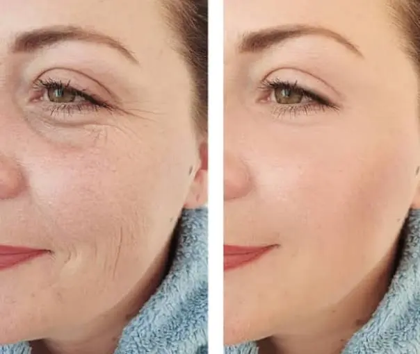 before-after