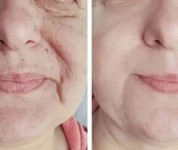 before-after
