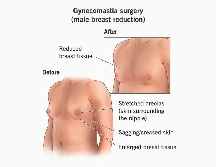 Procedure Overview