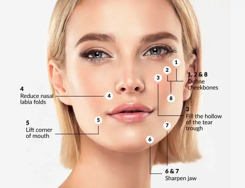 Procedure Overview