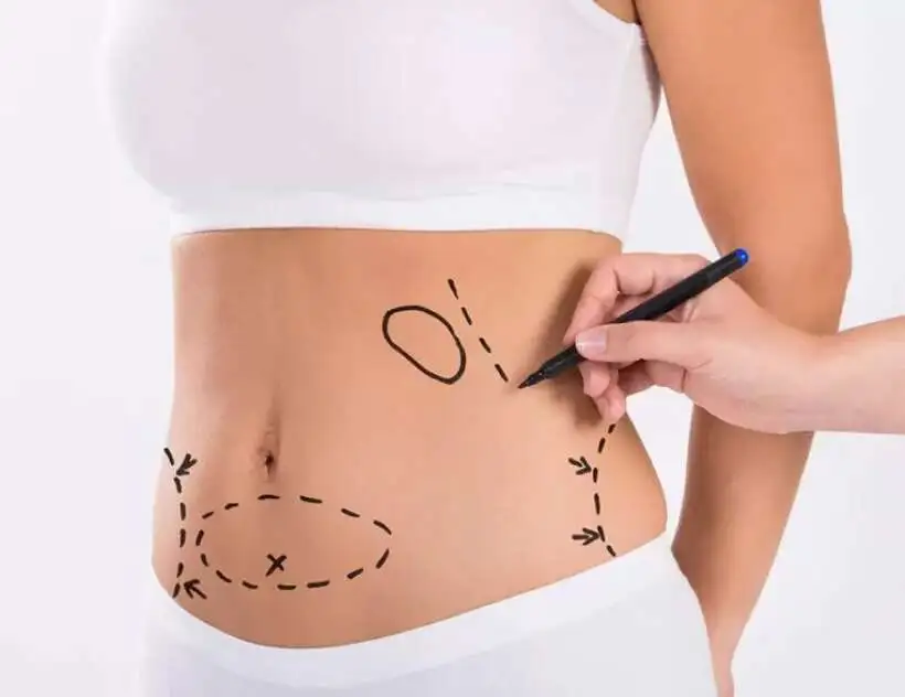 Procedure Overview