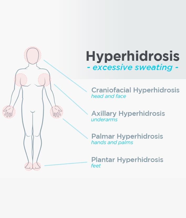 Hyperhidrosis Treatment in Ahmedabad | Phoenix Cosmetic Centre