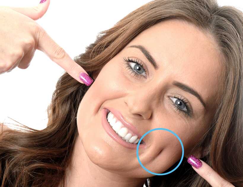 Advantages of dimple creation surgery ?