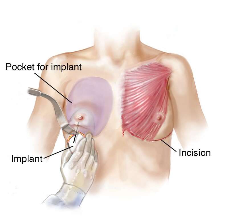 Procedure Description