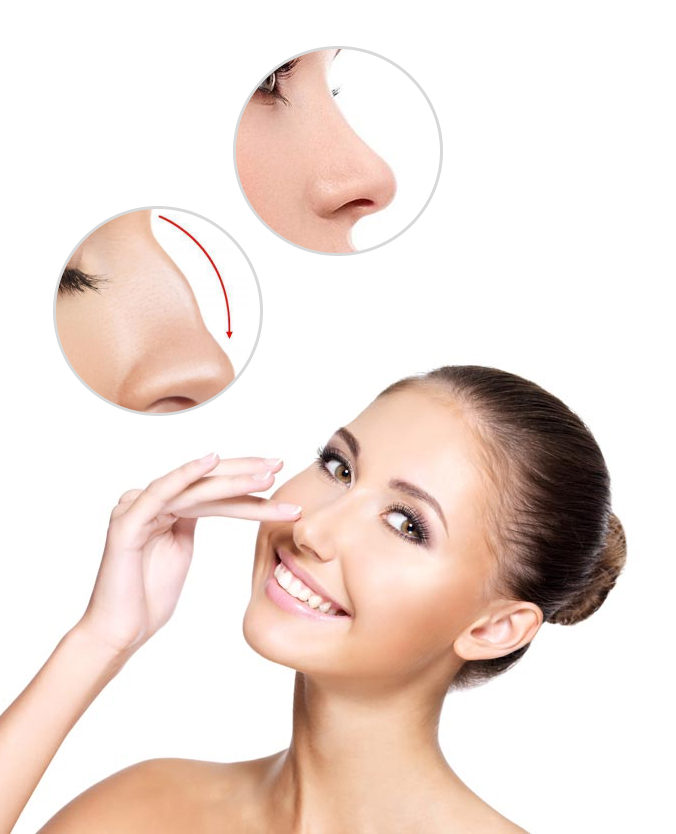 The Rhinoplasty Journey