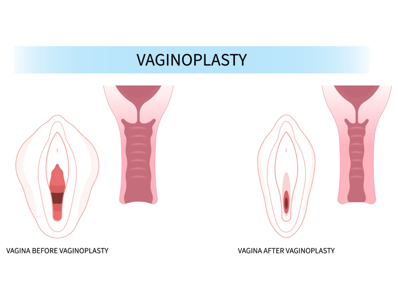 Why Choose Phoenix Cosmetic Centre?