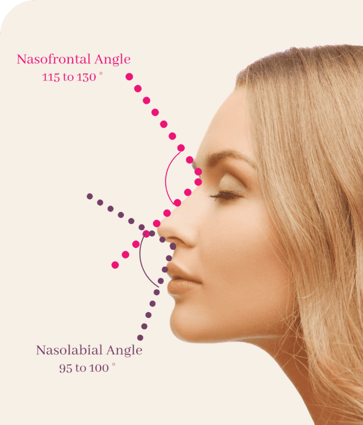 Why Consider Rhinoplasty?