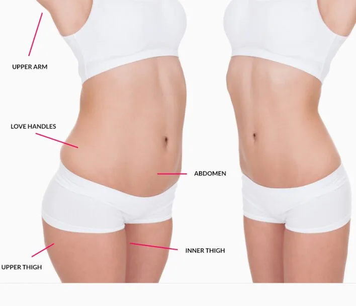 Post-Bariatric Body Lift Surgery with Dr. Kena Patel